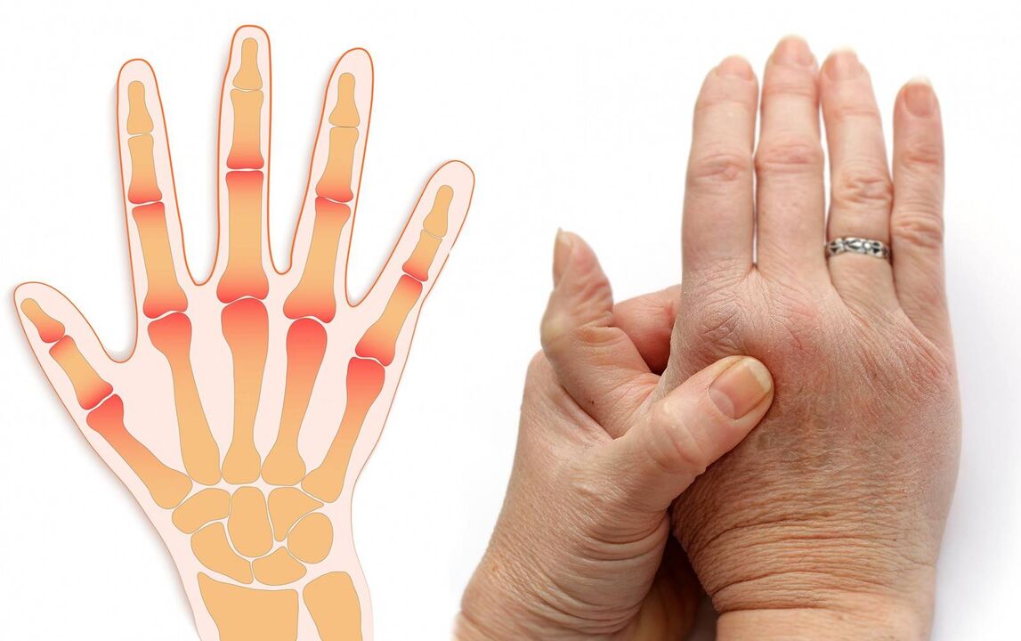 finger disease