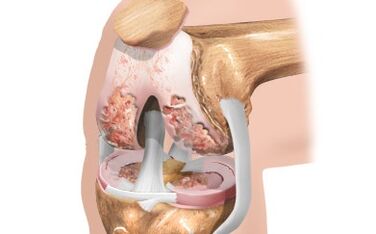 Ligamen scheme
