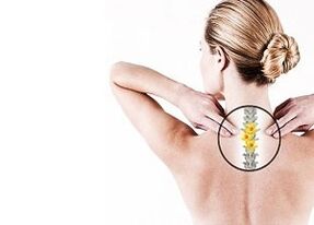 osteochondrosis of the thoracic spine