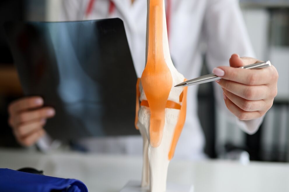 Demonstration of joints where degenerative changes lead to the development of arthrosis